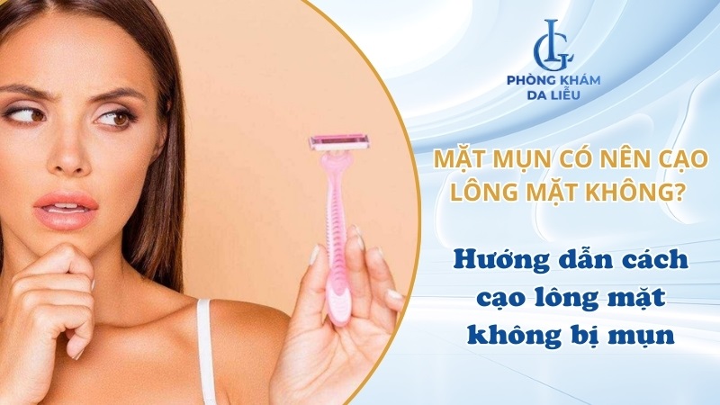 mặt mụn có nên cạo lông mặt không