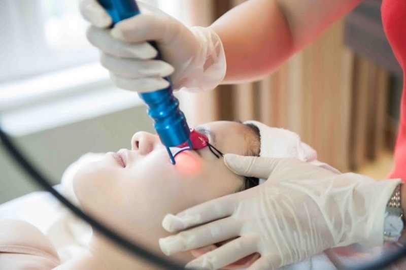 Trị mụn chuyên sâu bằng các phương pháp như Laser