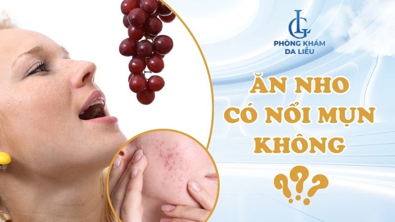 Ăn nho có nổi mụn không