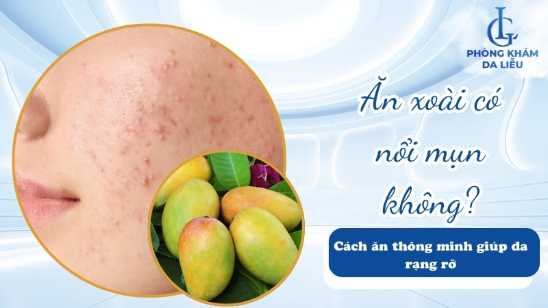 Ăn xoài có nổi mụn không
