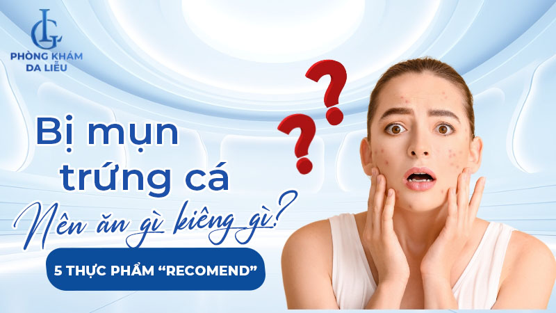 bị mụn trứng các nên ăn gì và kiêng gì