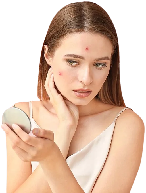 Nguyên nhân tri mụn