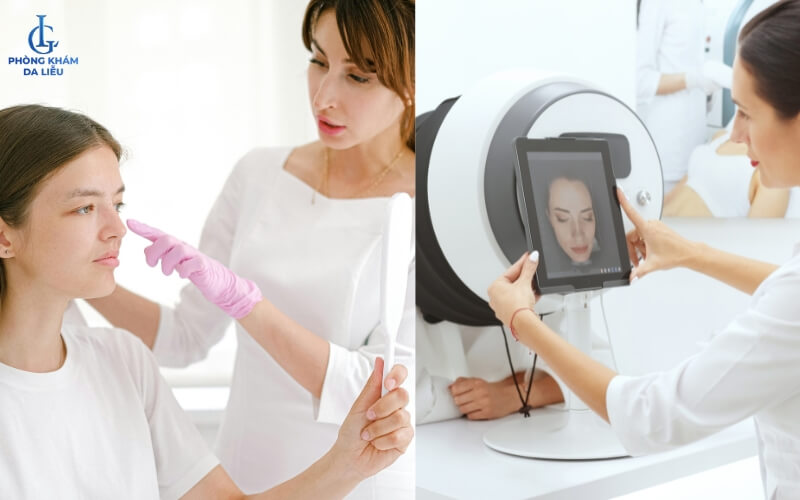 Bác sĩ da liễu khám mụn