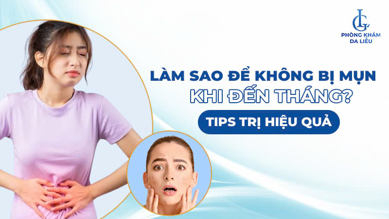 Làm sao để không bị mụn khi đến tháng