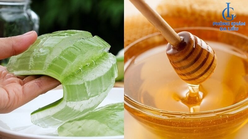 Nha đam và mật ong