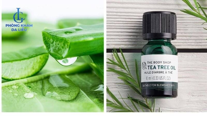 Điều trị mụn ngực bằng tinh dầu trà, nha đam