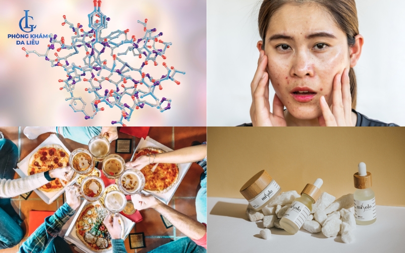 Nguyên nhân gây nên mụn bọc