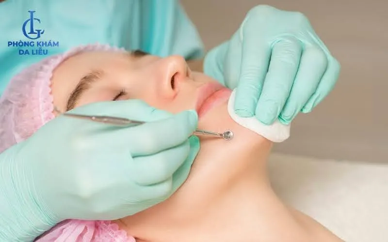 Phương pháp lấy nhân mụn chuẩn y khoa là biện pháp hỗ trợ điều trị mụn hiệu quả