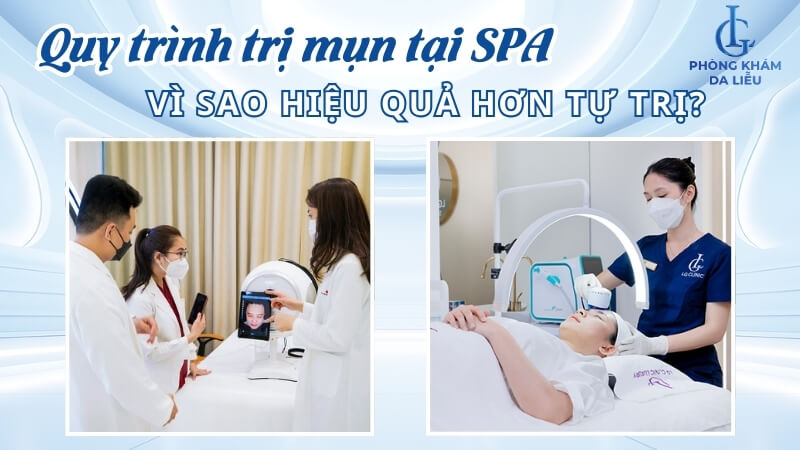 Quy trình trị mụn tại spa
