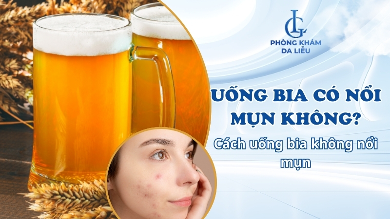 uống bia có nổi mụn không
