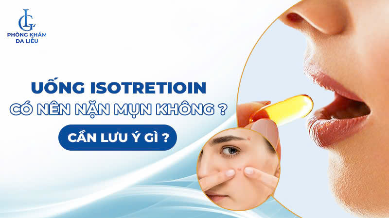 Uống Isotretinoin có nên nặn mụn không