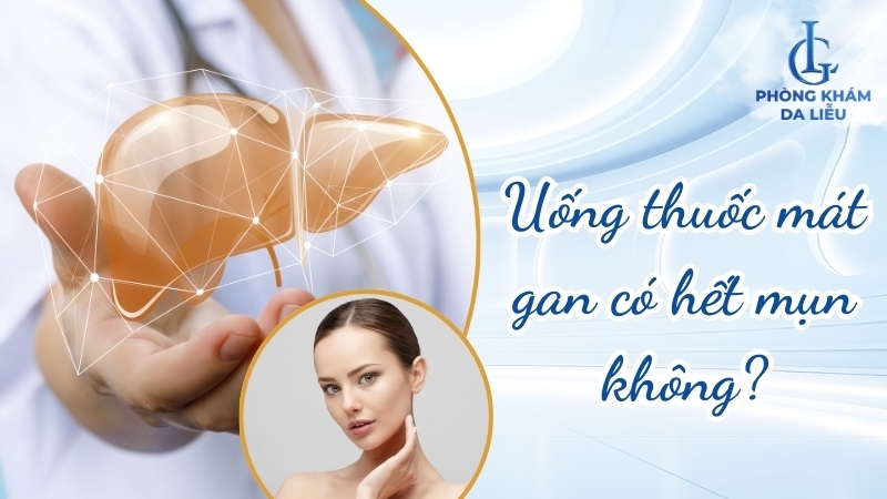uống thuốc mát gan có hết mụn không