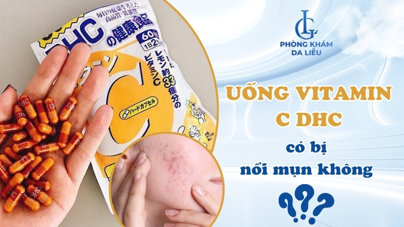 Uống vitamin C DHC có bị nổi mụn không?