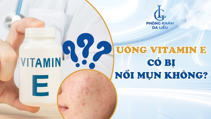 uống vitamin e có bị nổi mụn không