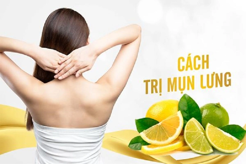 cách trị mụn lưng