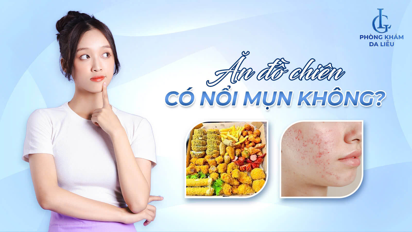 Ăn đổ chiên có gây nổi mụn không
