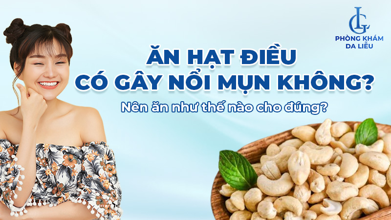 Ăn hạt điều có nổi mụn không?