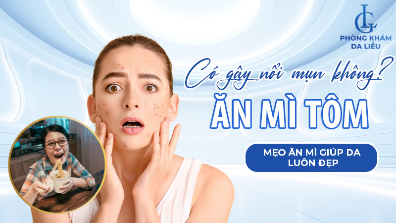 Ăn mì tôm có mọc mụn không