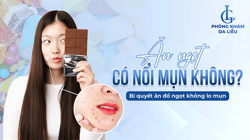 Ăn ngọt có gây nổi mụn không