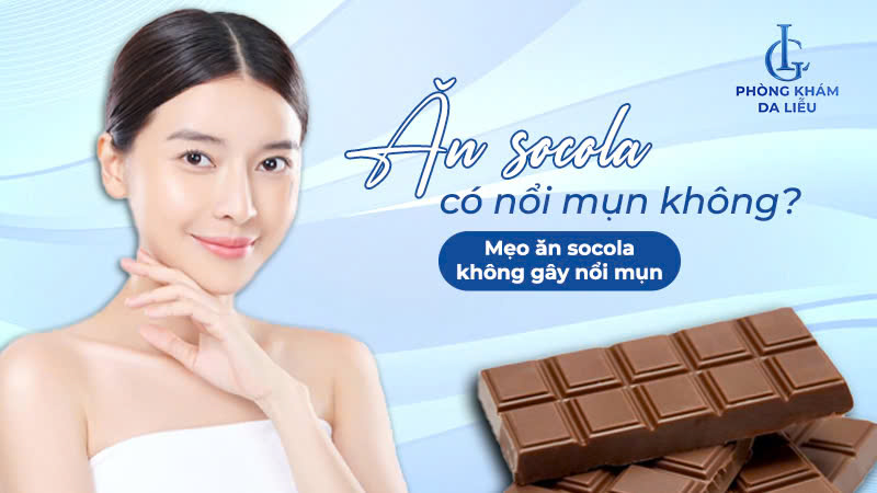 Ăn Socola có nổi mụn không