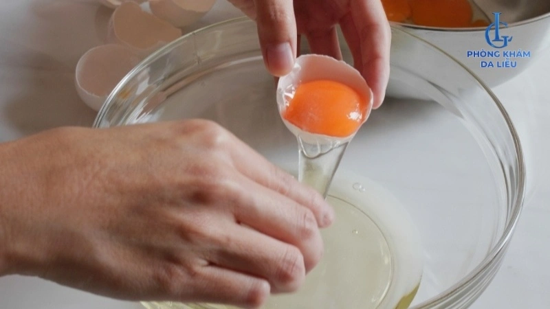 Công thức trứng gà và baking soda trị mụn lưng