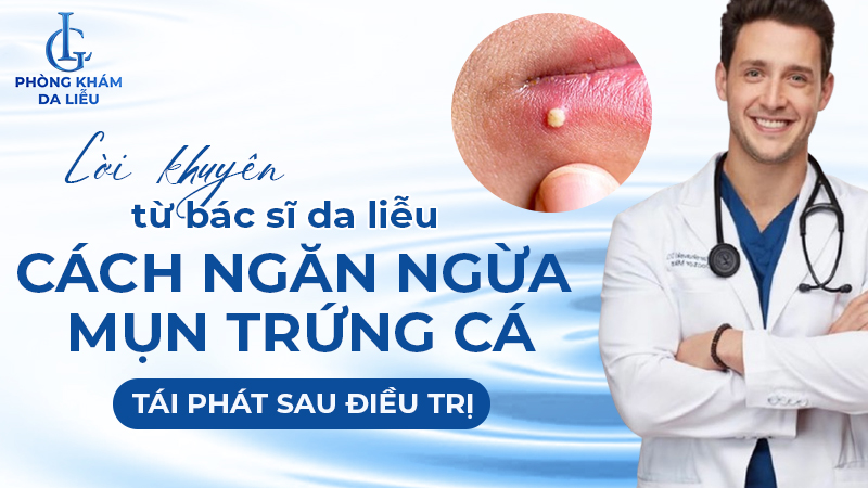 Cách ngăn ngừa mụn trứng cá