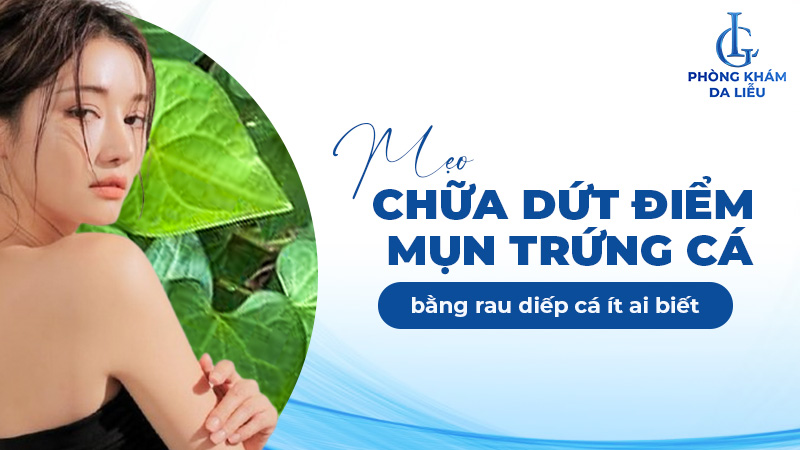 chữa mụn trứng cá bằng rau diếp cá