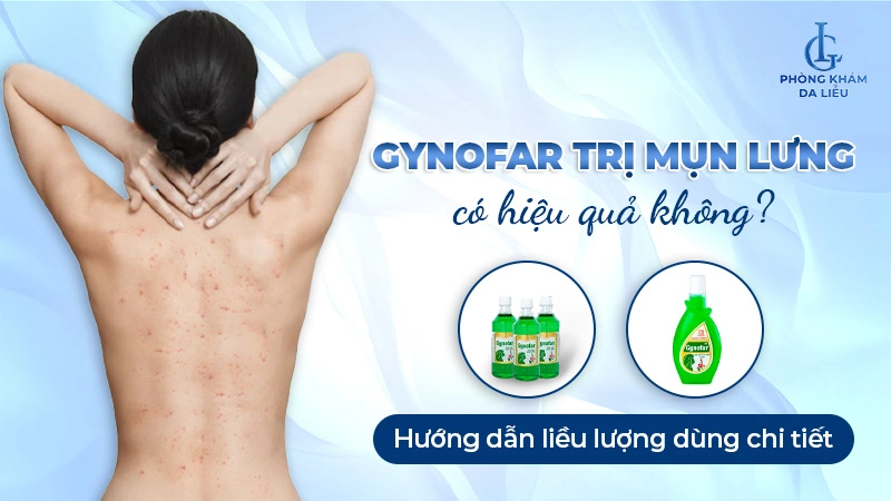 Cách dùng Gynofar trị mụn lưng