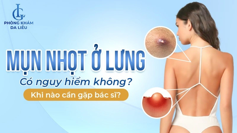 mụn nhọt ở lưng