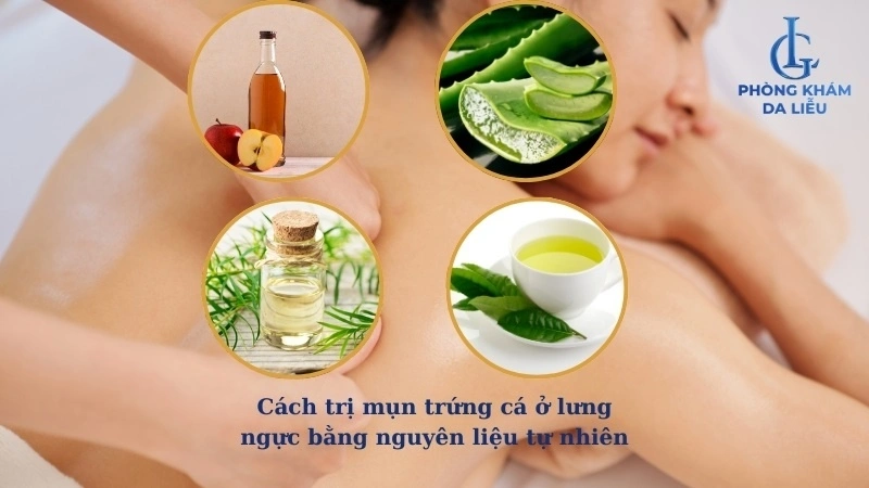 cách trị mụn trứng cá ở lưng ngực
