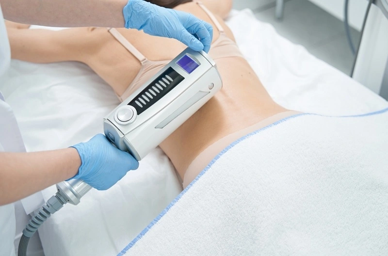 trị mụn trứng cá ở lưng bằng công nghệ cao