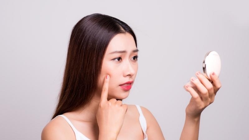 làm thế nào để hết mụn trứng cá ở trán​