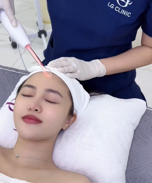 Trị mụn trứng cá ung bằng laser