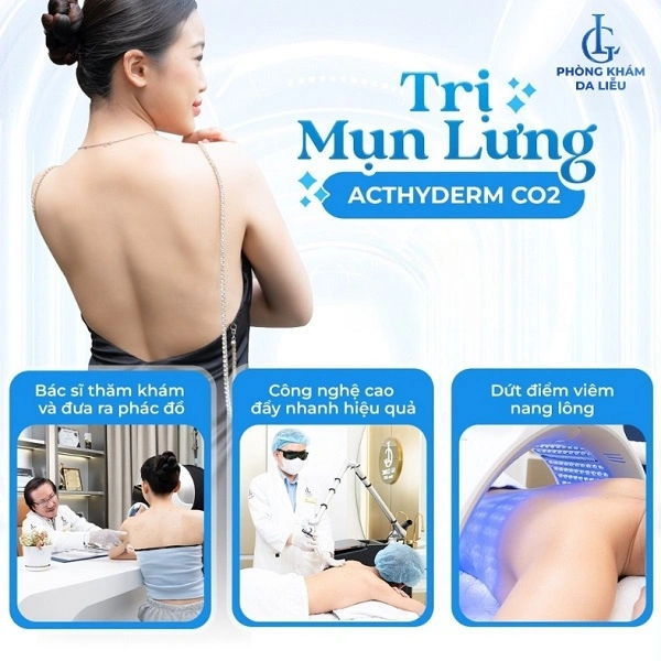 Phòng khám da liễu LG trị mụn lưng