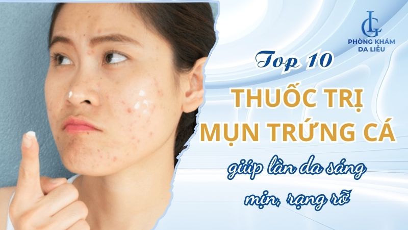 thuốc trị mụn trứng cá