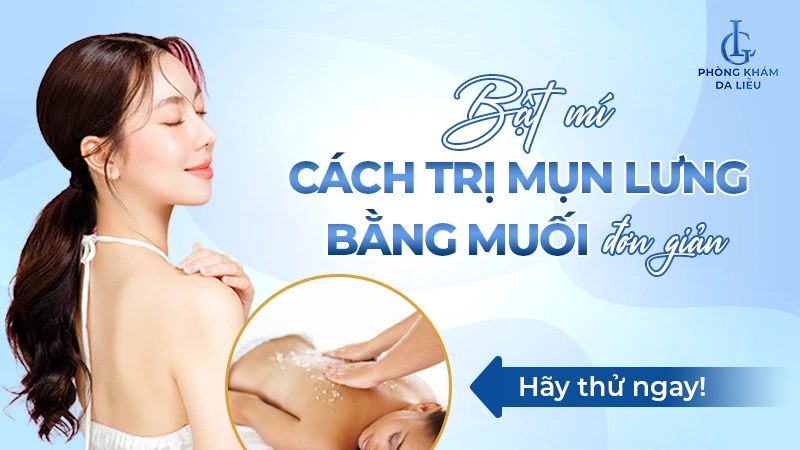 Cách trị mụn lưng bằng muối 
