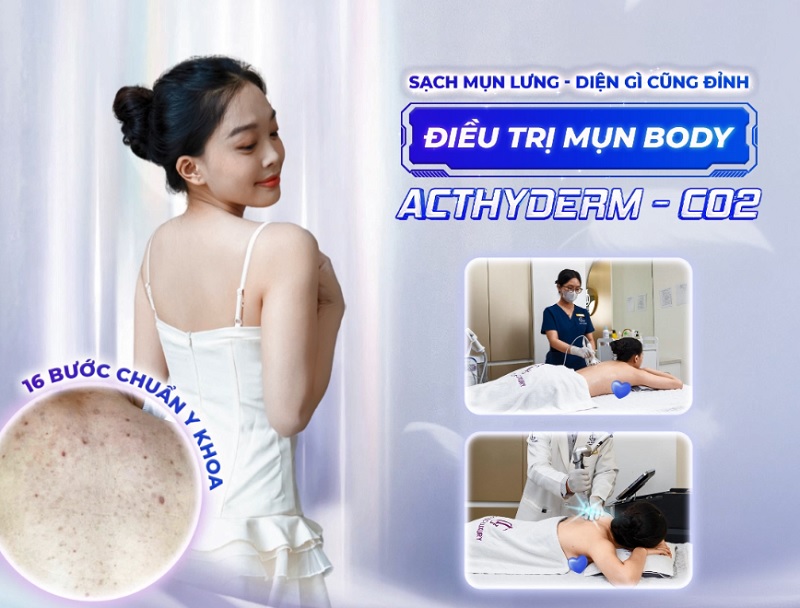 Khách hàng hài lòng với làn da sạch mụn sau liệu trình tại Phòng khám da liễu LG
