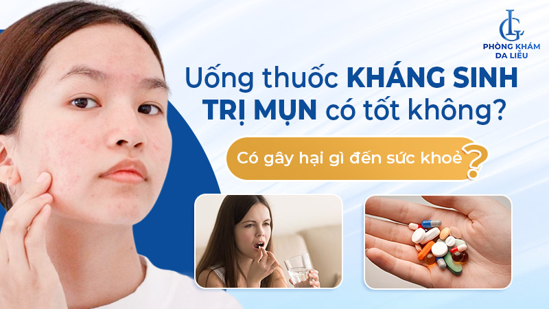Uống thuốc kháng sinh trị mụn