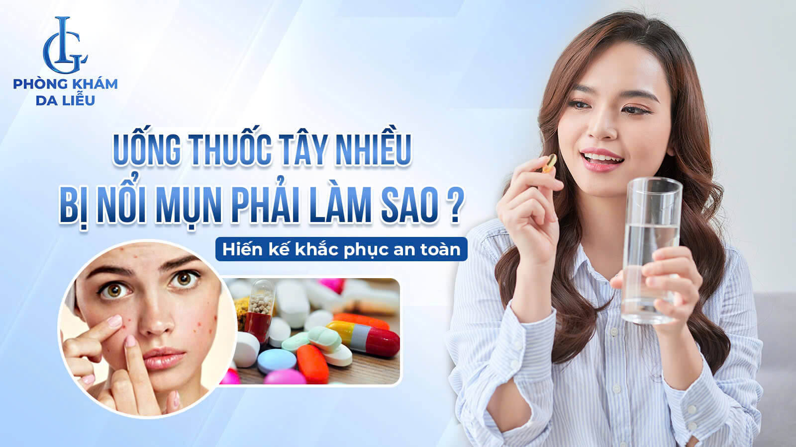 Uống thuốc tây nhiều bị nổi mụn phải làm sao