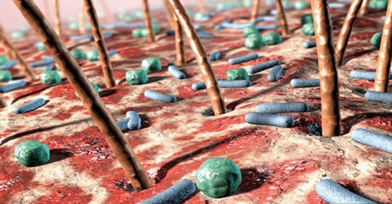 vi khuẩn gây mụn​