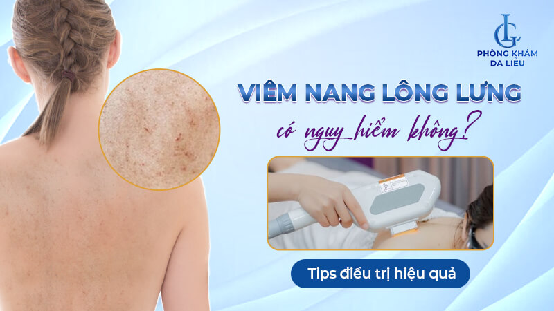 viêm nang lông lưng