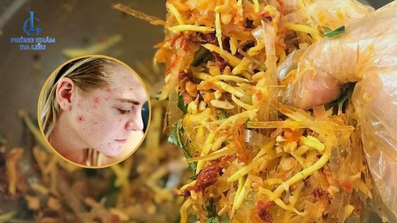 Ăn bánh tráng có nổi mụn hay không