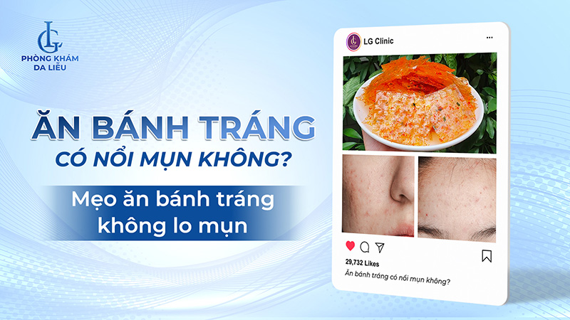 Ăn bánh tráng có nổi mụn không