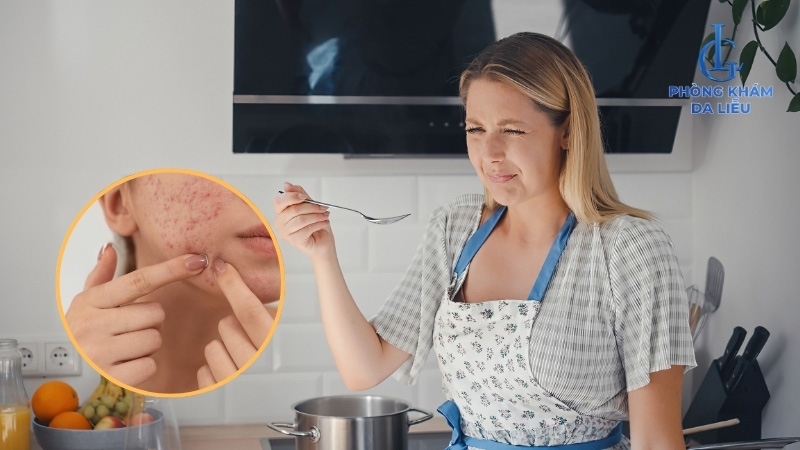 Ăn mặn góp phần tạo nên tình trạng nổi mụn