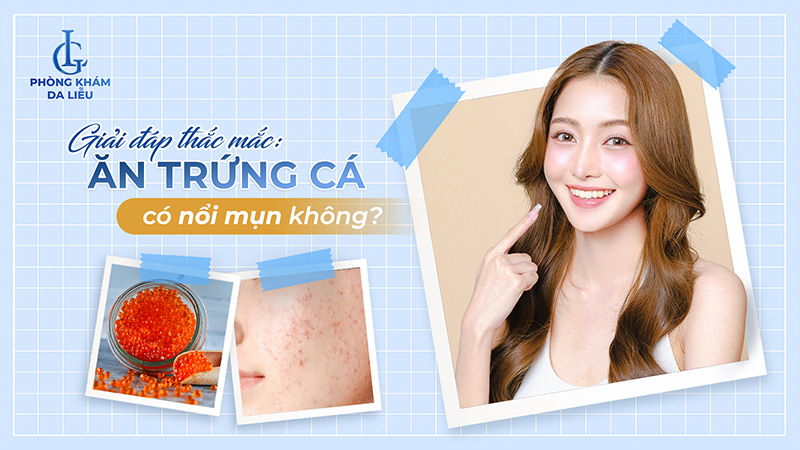 Ăn trứng cá có nổi mụn không