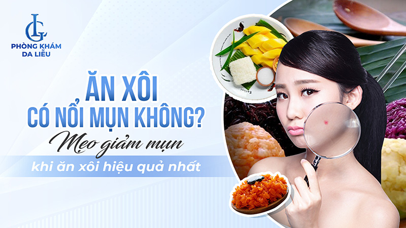 Ăn xôi có nổi mụn không