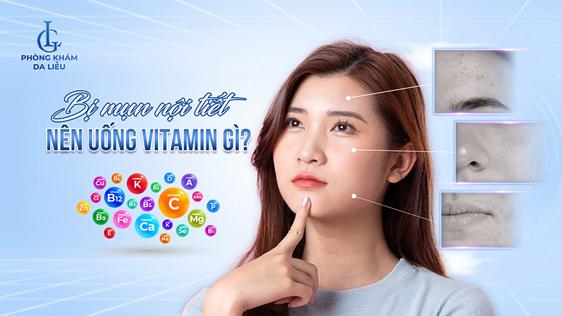 Bị mụn nội tiết nên uống vitamin gì