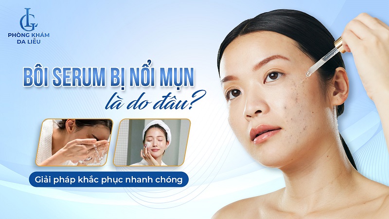 bôi serum bị nổi mụn