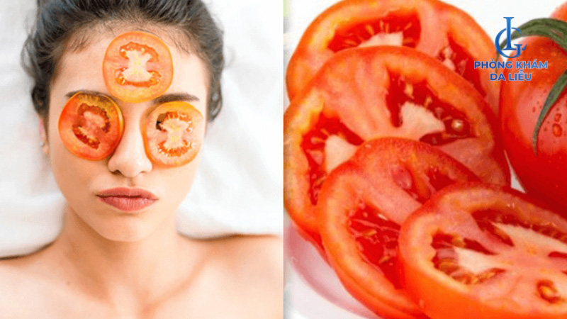Mặt nạ cà chua trị mụn và làm trắng da