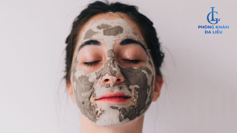 Mặt nạ đất sét trị mụn và làm trắng da